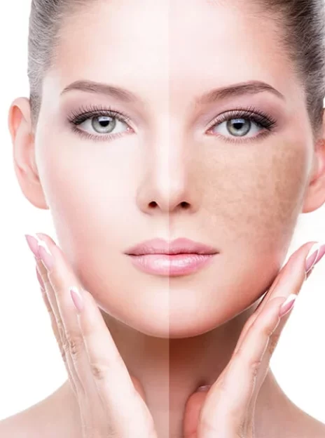 Skin Brightening Topicals